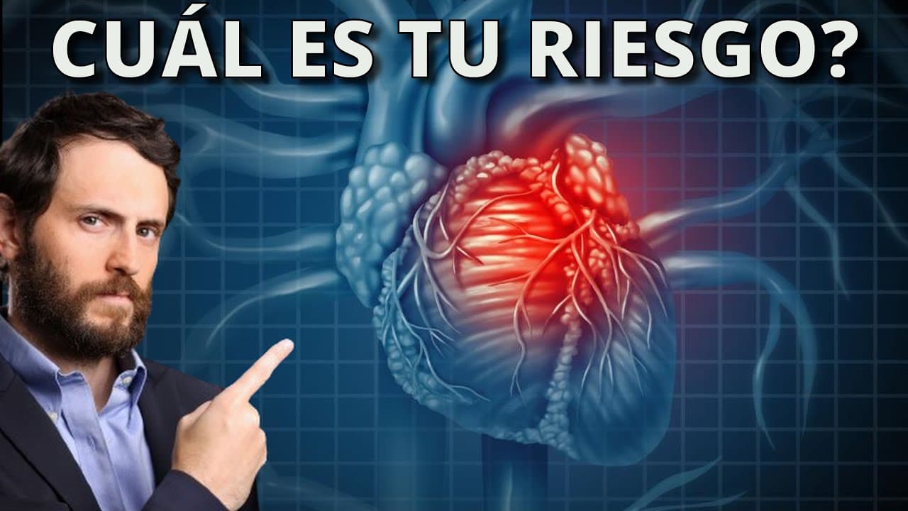 Miniatura del video de YouTube aglzlUUd_ds.