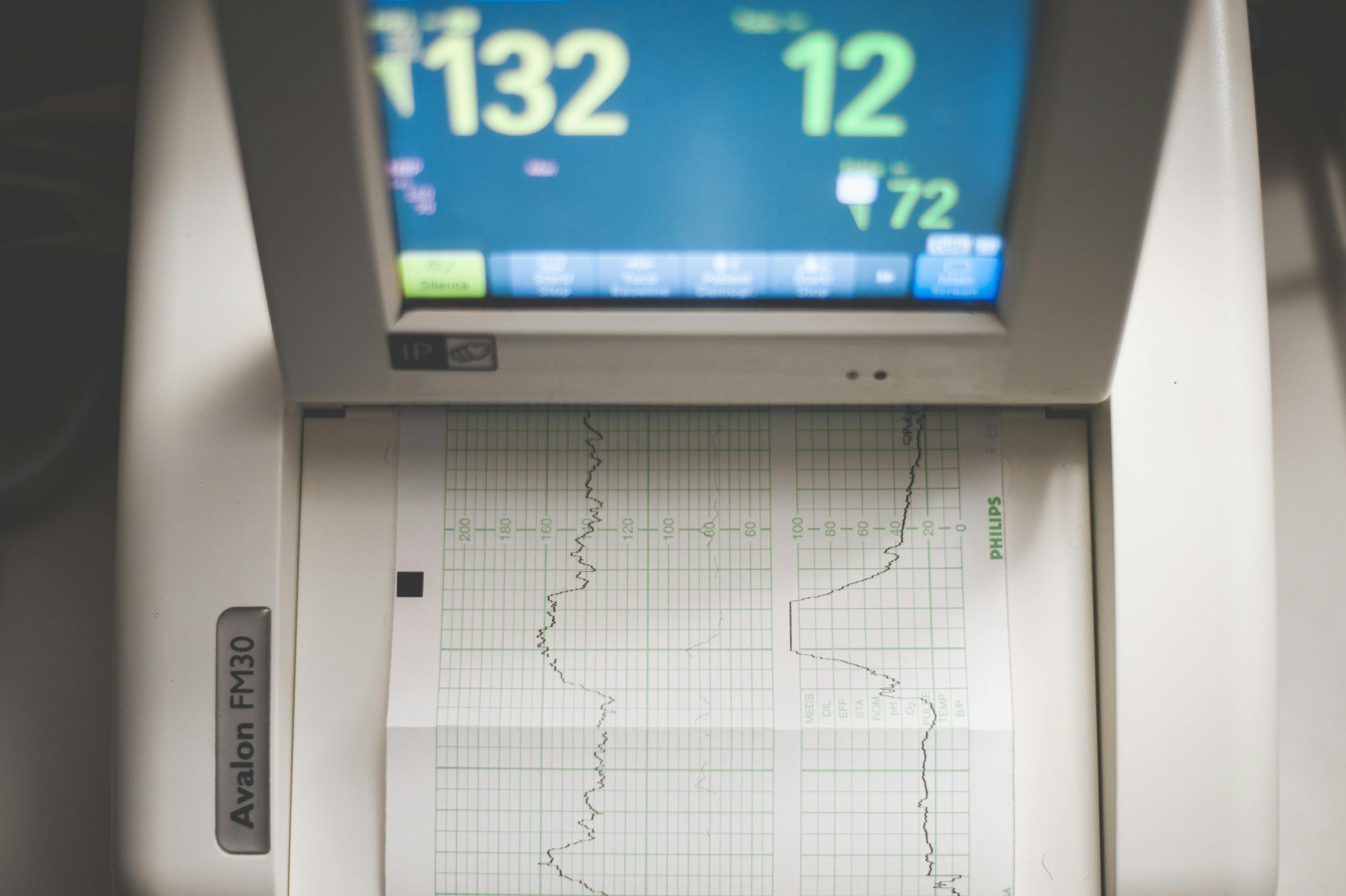 Patrón de frecuencia cardíaca. La forma de onda ESC de un paciente en un monitor, dispositivo médico que muestra un gráfico con ECG.